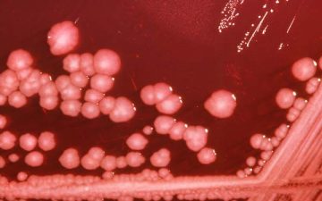 A propósito de las bacterias multirresistentes y la situación en nuestro país