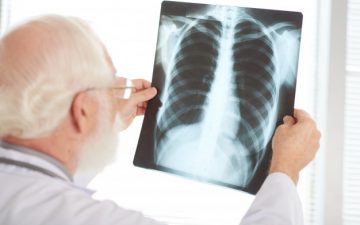 Recomendaciones para pacientes con enfermedades respiratorias crónicas en tiempos de COVID-19.