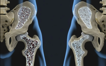 Jornadas sobre patologías tiroideas y osteoporosis