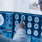 jornada Esclerosis Múltiple Neuromielitis Óptica