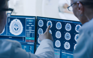 Simposio internacional sobre Esclerosis Múltiple y Neuromielitis Óptica