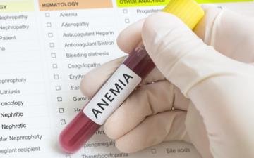 Taller: Anemia en el adulto mayor
