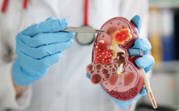 Llamado a concurso para un cargo en nefrología en el FNR